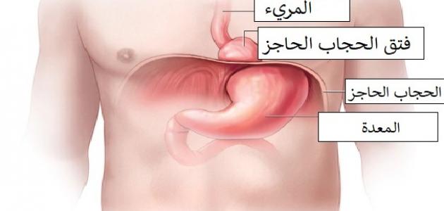 اسباب فتق الحجاب الحاجز - فتق الحجاب الحاجز و علاماته 369 11