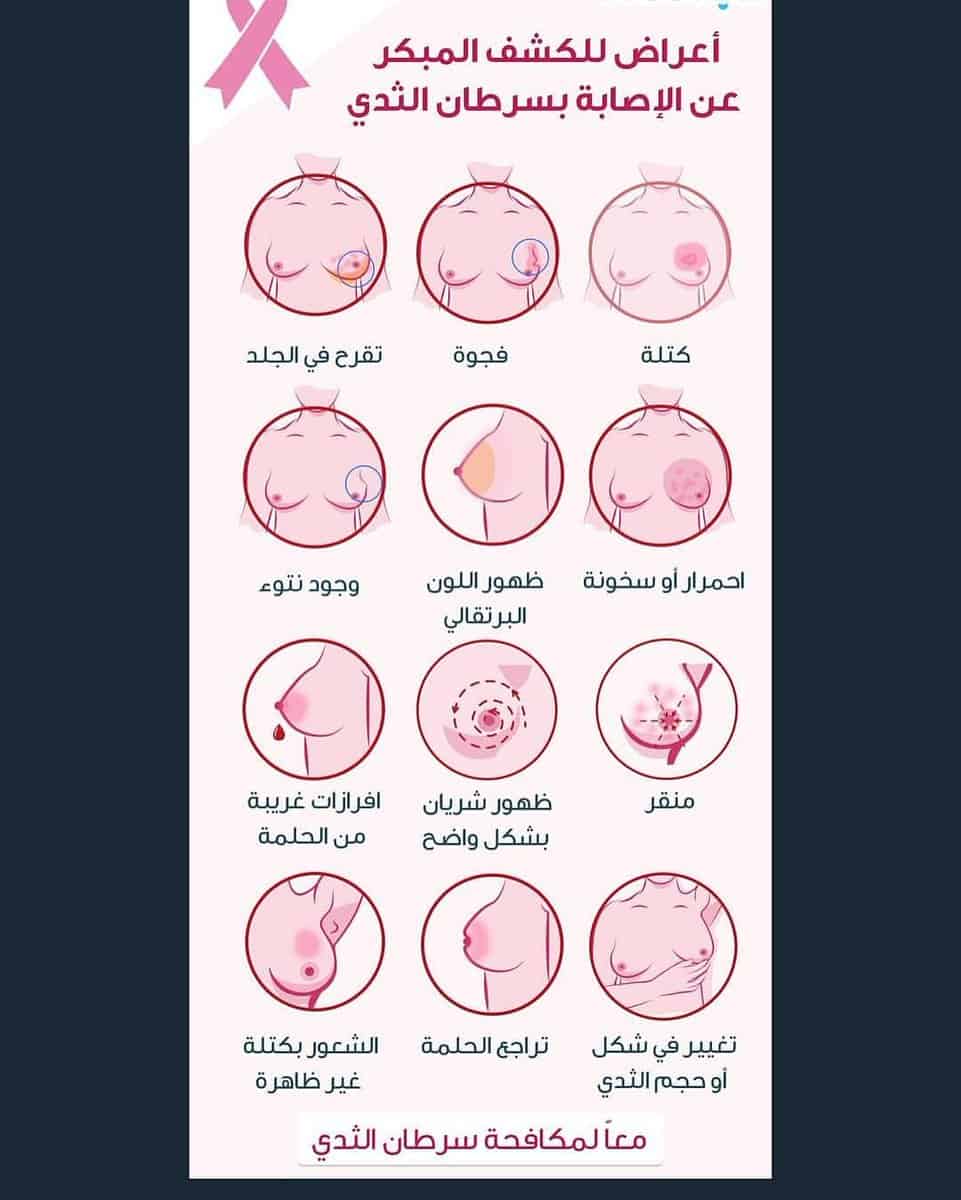 اول اعراض سرطان الثدي , خطورة المرض واعراضه تعرفي عليها