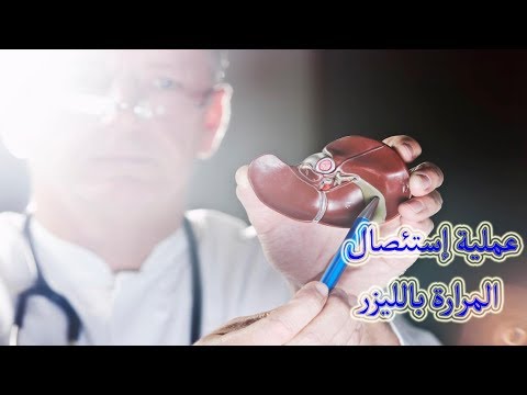 اضرار استئصال المرارة - ما لا تعرفه عن توابع العمليات الجراحيه للمرارة 3103 2