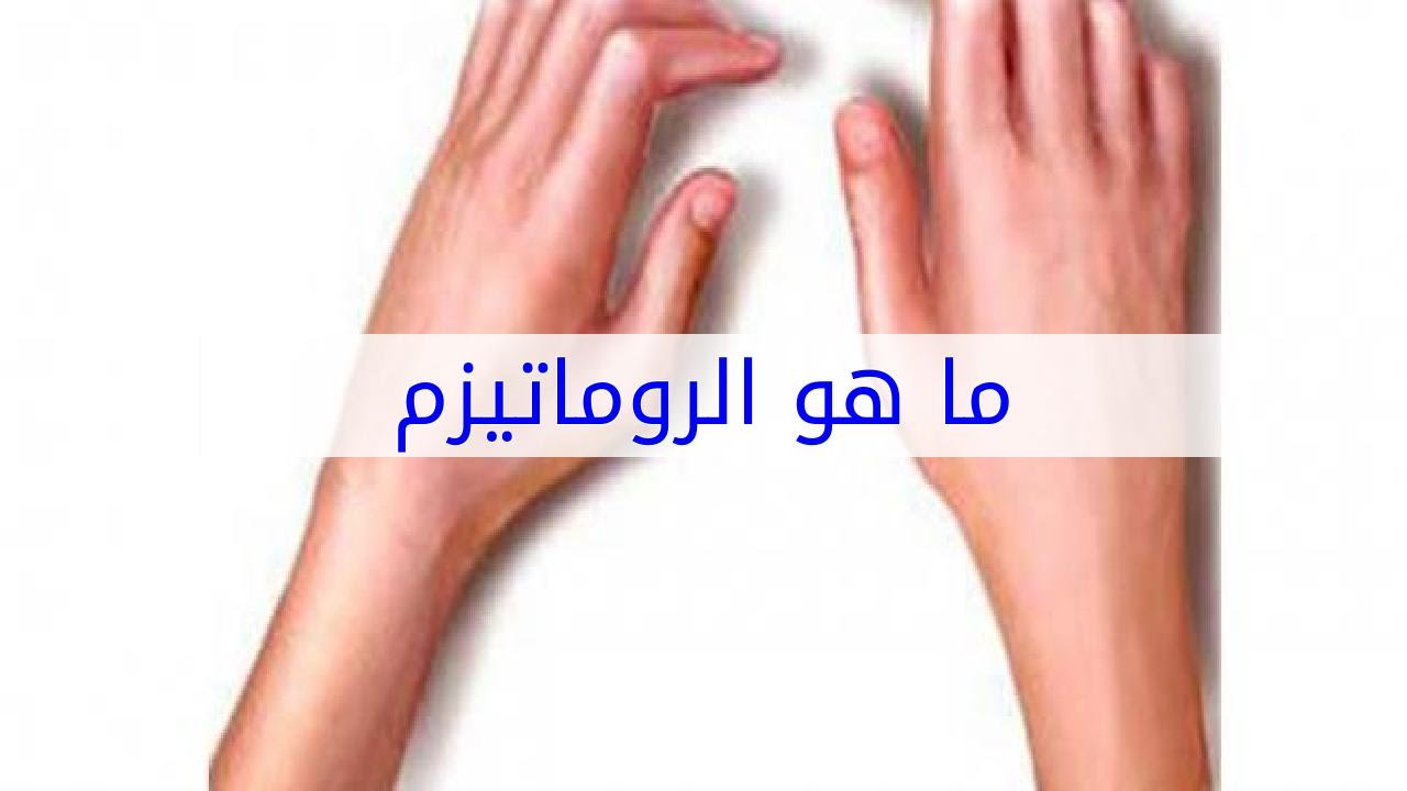 ما هو مرض الروماتيزم , حالات واعراض مرض العصر