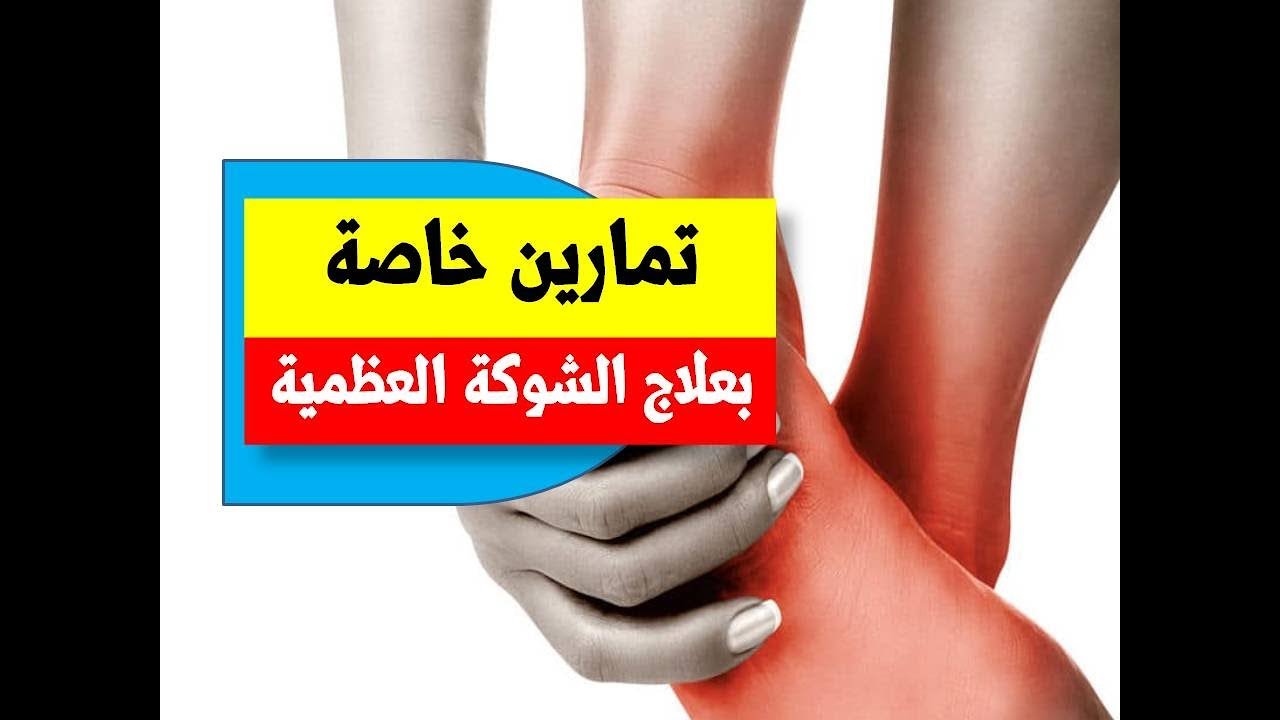 علاج الشوكة العظمية بالليزر , اسباب الشوكه العظميه واحدث العلاجات